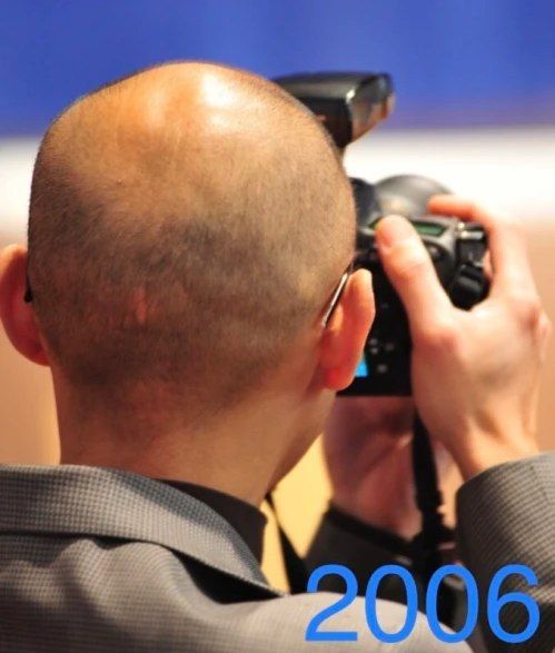 دکتر تامی کورن در سال ٢٠٠۶ در حین عکاسی از چشم بیمار با دوربین حرفه‌ای