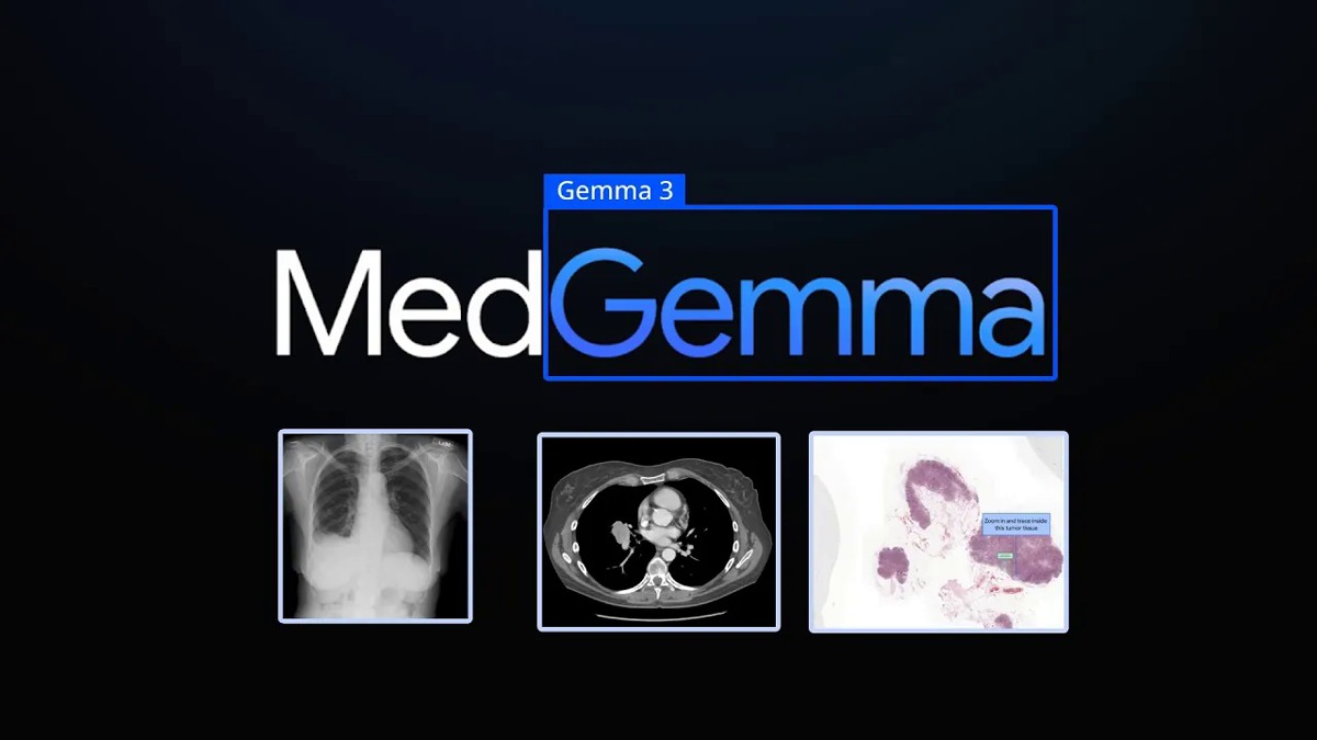 گوگل از MedGemma، مجموعه مدل هوش مصنوعی متن‌باز برای کاربردهای پزشکی، رونمایی کرد