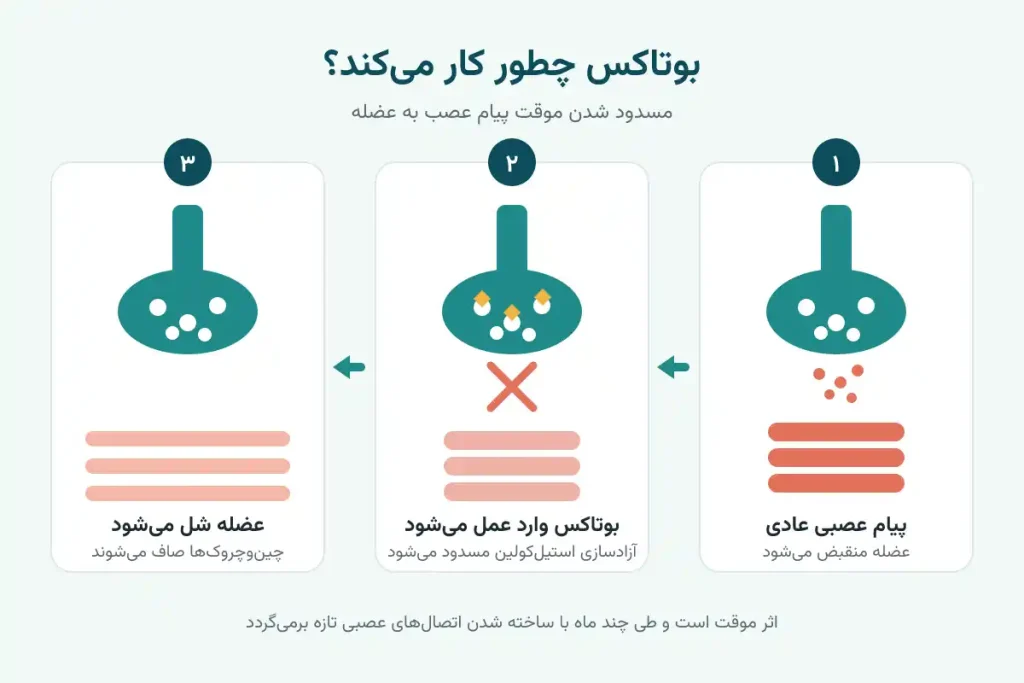 نحوه اثر بوتاکس روی اتصال عصب و عضله